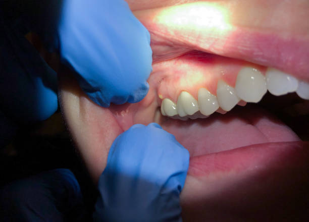 Best After-Hours Dental Trauma Care in Coleytown, CT