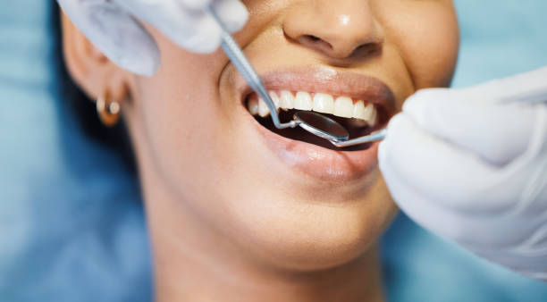Best Emergency Treatment for Dental Infections or Abscesses in Coleytown, CT